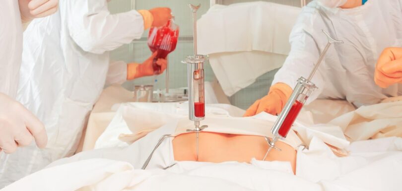 Bone Marrow Transplant Process